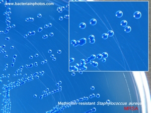 MRSA on oxacillin resistance screening agar, colony appearance
